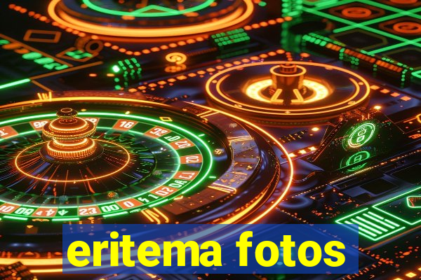 eritema fotos